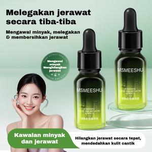 Huyết Thanh Trị Mụn Trứng Cá Chai Xanh Lá Cây, MSMEESHU, Kiểm Soát Dầu, Thanh Lọc Da, Cải Thiện Mụn Đầu Đen Và Mụn Nhọt, Chăm Sóc Nhẹ Nhàng Cho Da Nhạy Cảm Với Mụn